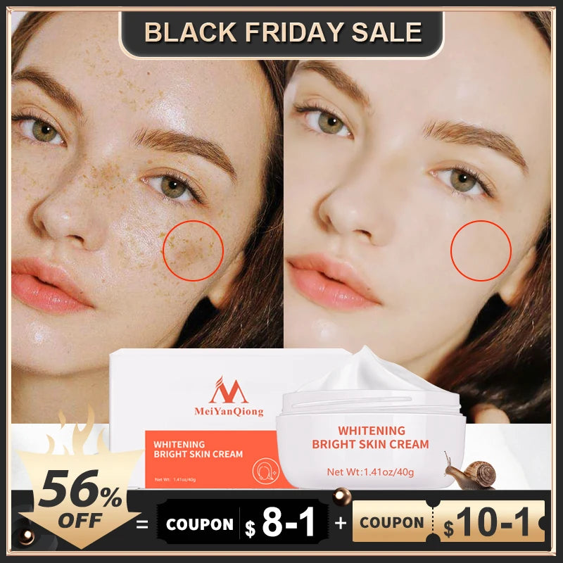 Moisturiser Face Whitening Freckle Cream Remove Acne Spots