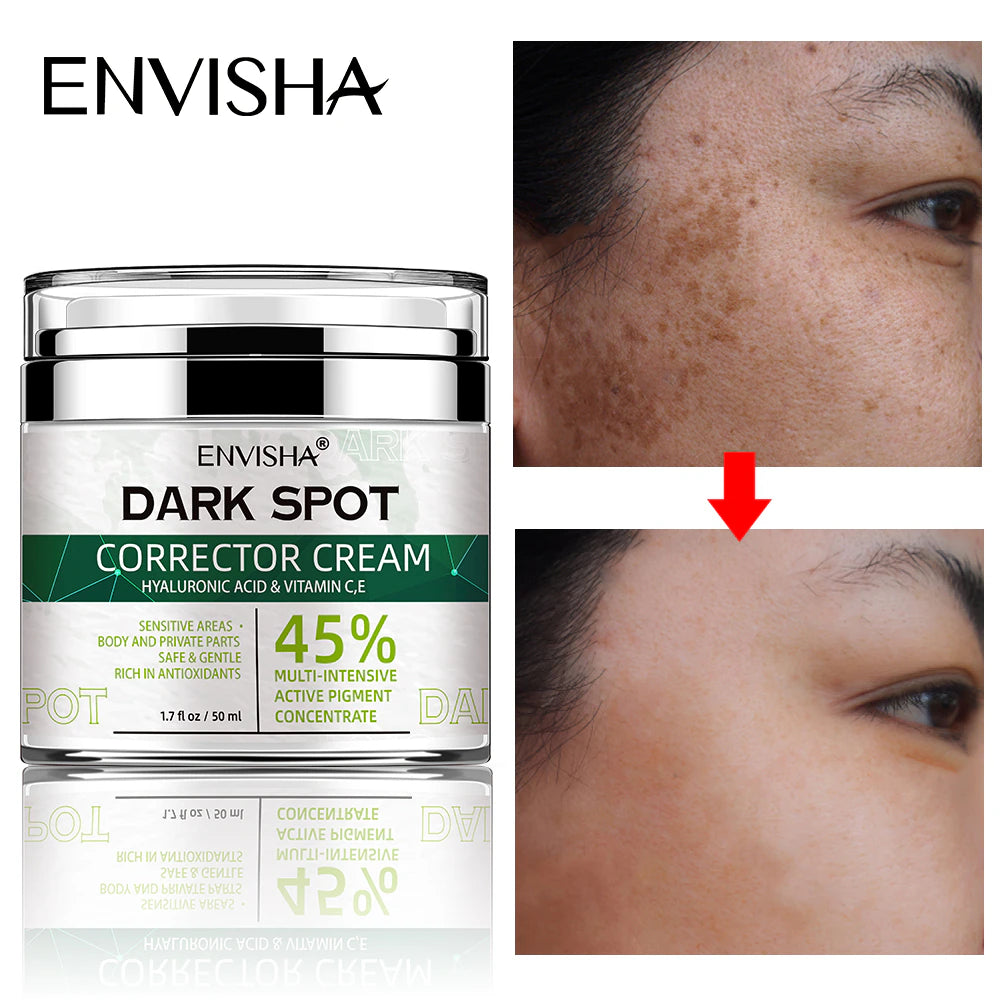 Face Skin Care Whitening Freckle Cream Remove Melasma Dark Spots Melanin Anti-Aging Lightening Shrink Pores Moisturizing