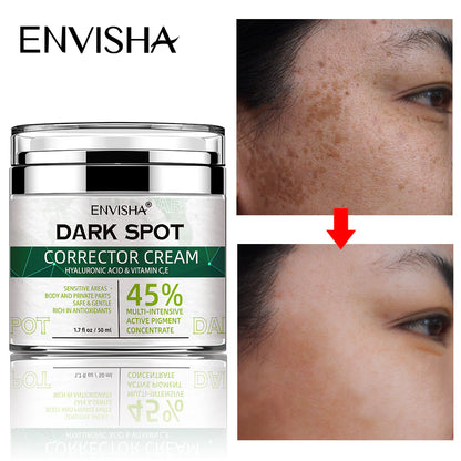 Face Skin Care Whitening Freckle Cream Remove Melasma Dark Spots Melanin Anti-Aging Lightening Shrink Pores Moisturizing