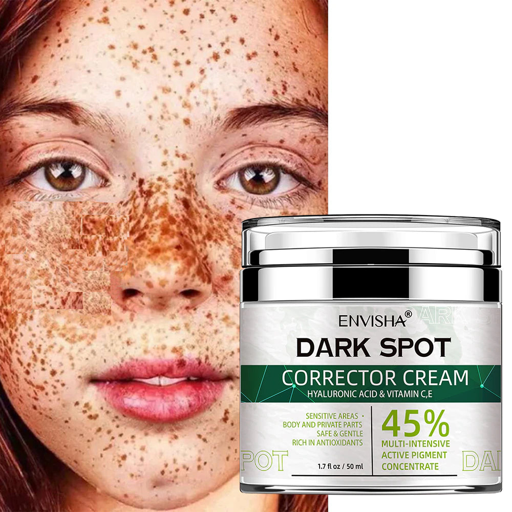 Face Skin Care Whitening Freckle Cream Remove Melasma Dark Spots Melanin Anti-Aging Lightening Shrink Pores Moisturizing