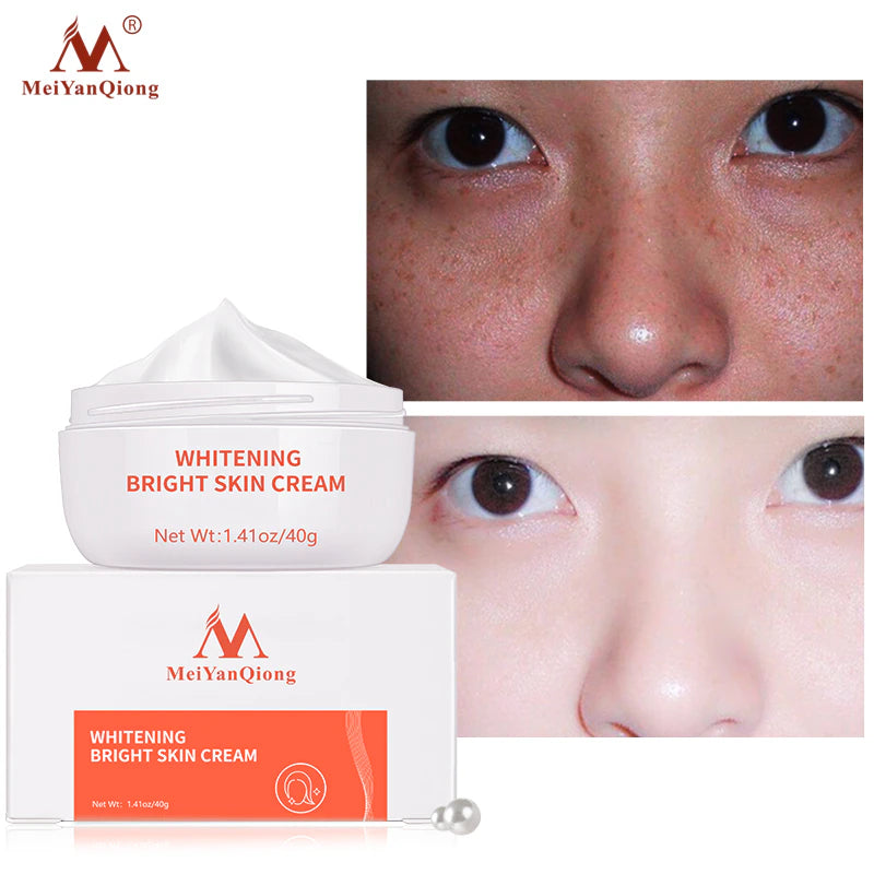 Moisturiser Face Whitening Freckle Cream Remove Acne Spots