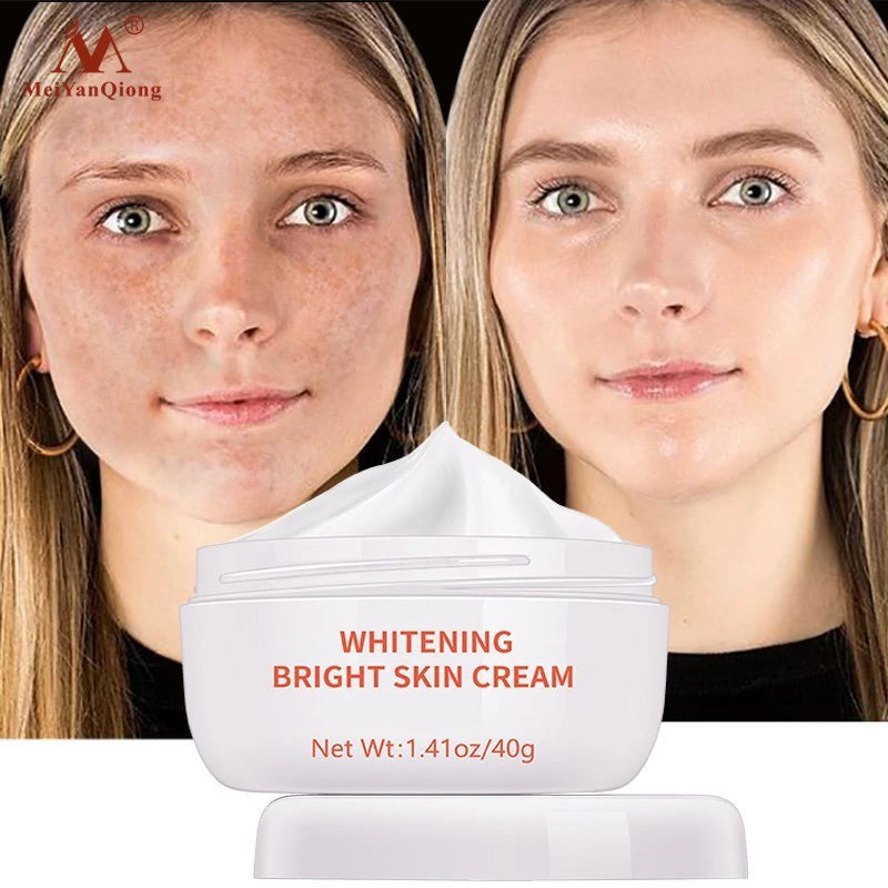 Moisturiser Face Whitening Freckle Cream Remove Acne Spots